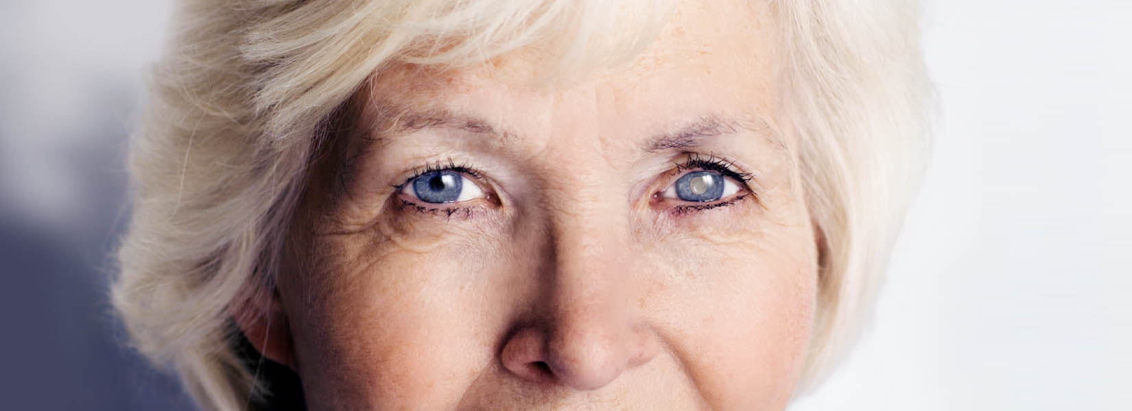 Cataract Surgery in Inglewood-Finn Hill